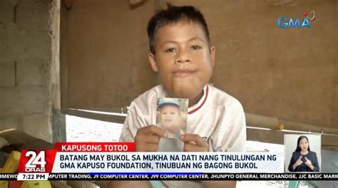 paano humingi ng tulong sa gma kapuso foundation|Layunin ng GMA Kapuso Foundation .